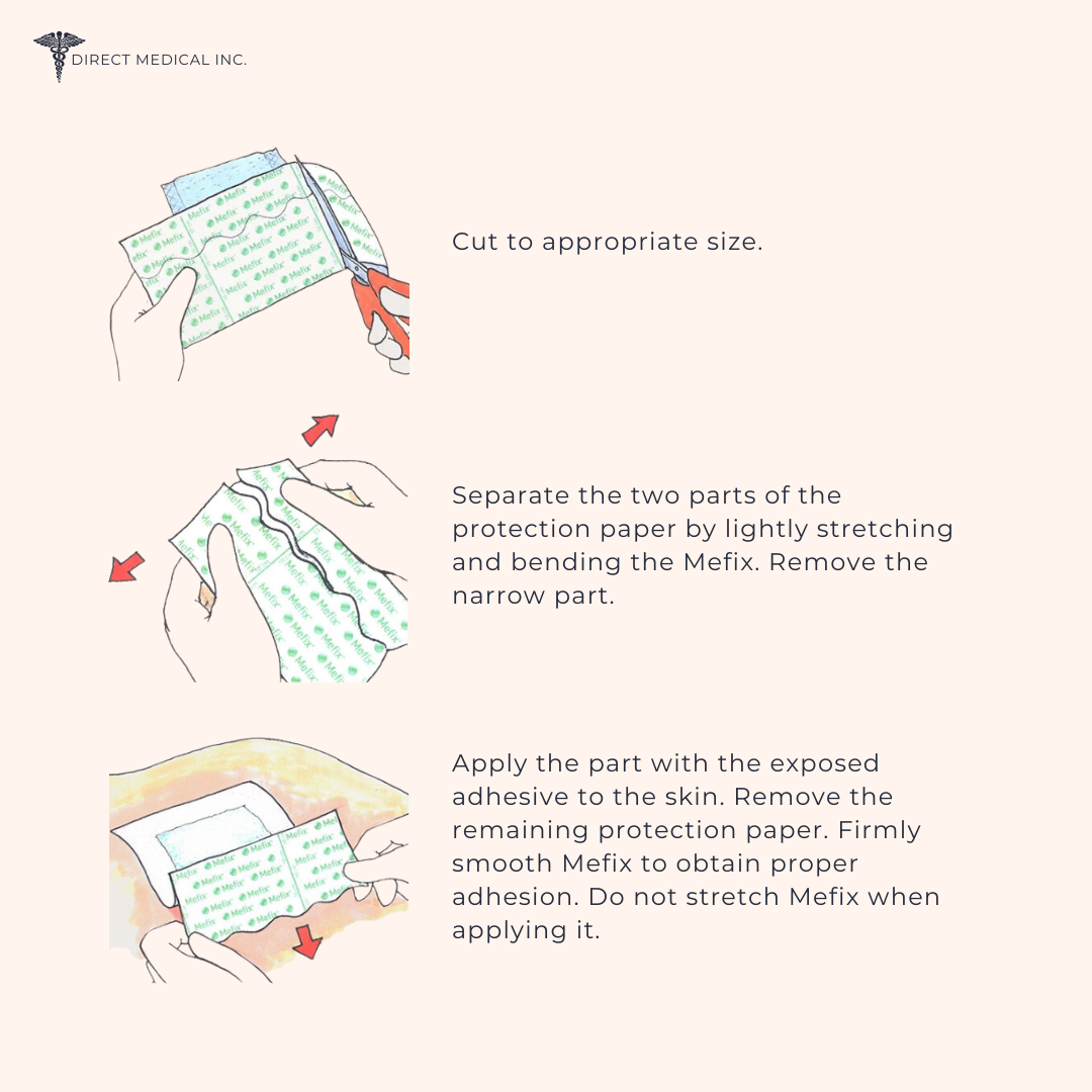 Mefix Self-Adhesive fabric tape image of how to apply. | Direct Medical Inc.
