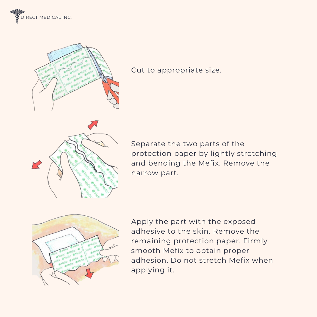 Mefix Self-Adhesive fabric tape image of how to apply. | Direct Medical Inc. 