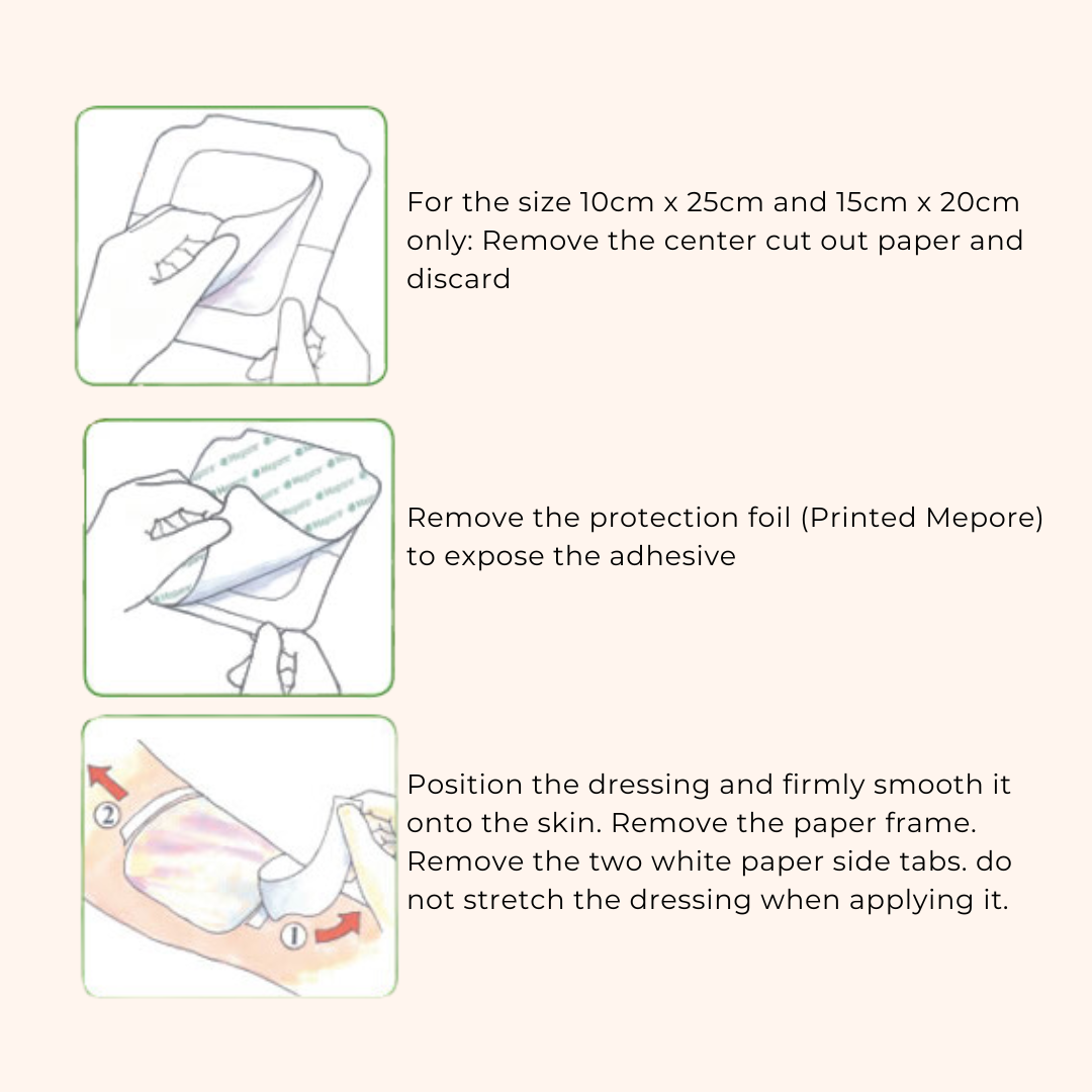 Molnlycke Mepore Film - 4"x5"